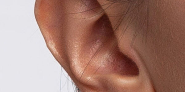 Ear 1